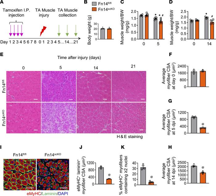 Satellite cell–specific ablation of Fn14 inhibits muscle regeneration.
(...