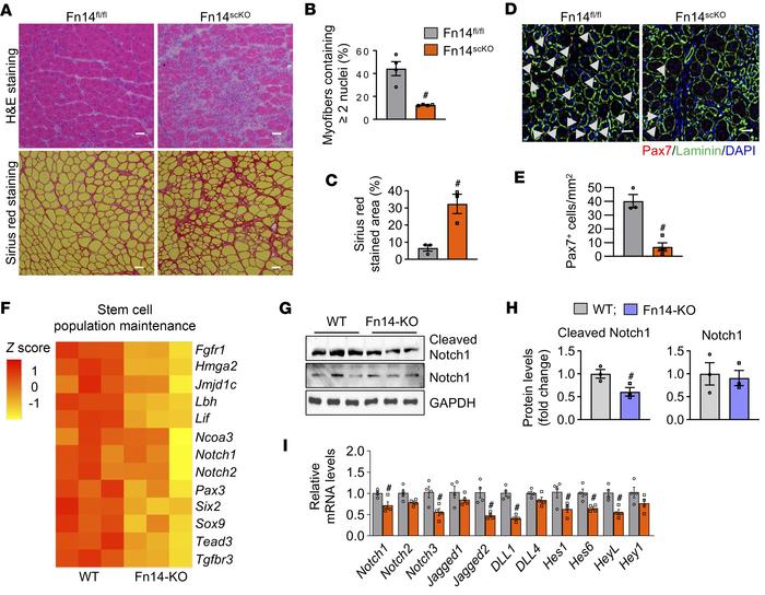 Fn14 promotes satellite cell self-renewal.
(A) TA muscle of Fn14fl/fl an...