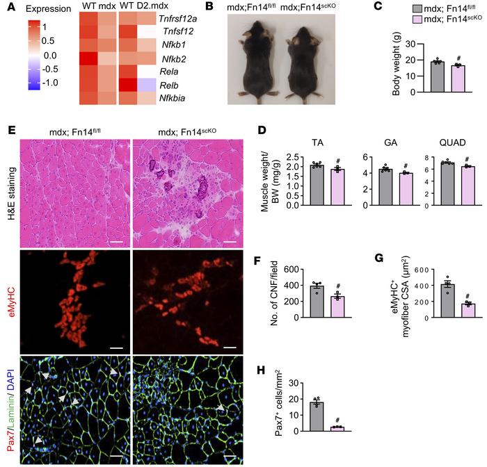 Satellite cell–specific ablation of Fn14 exacerbates dystrophic phenotyp...