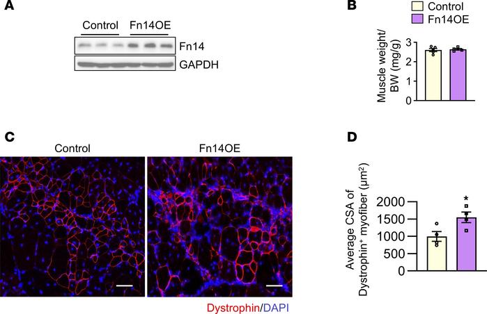 Overexpression of Fn14 improves engraftment of myoblasts into dystrophic...