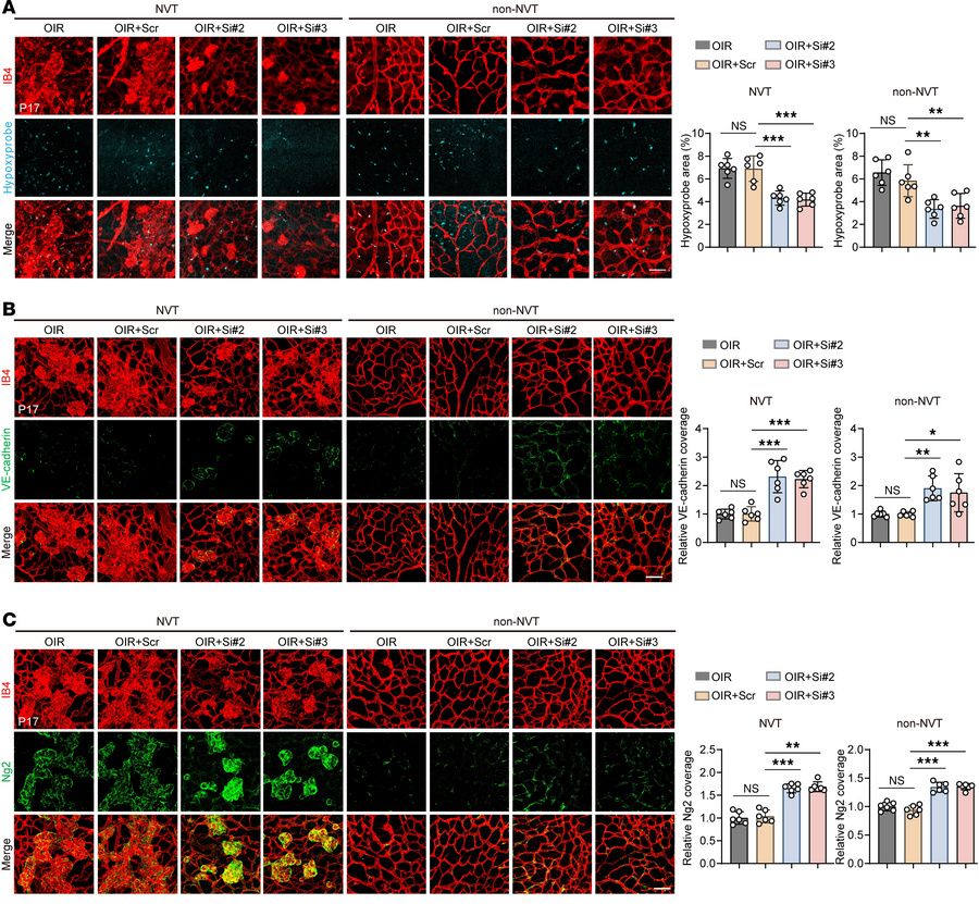Cavin3 deficiency promotes vascular normalization by partially restoring...