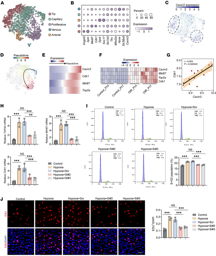 CAVIN3 deficiency inhibits EC proliferation in pathological conditions.
...
