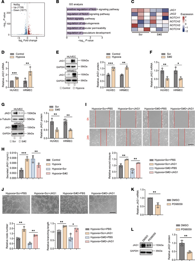 CAVIN3 deficiency downregulates JAG1 by inhibiting ERK phosphorylation.
...