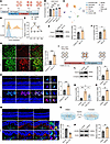 Cavin3 is upregulated in ocular neovascularization models.