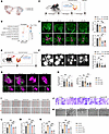 CAVIN3 deficiency prevents pathological neovascularization.