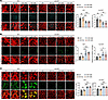 Cavin3 deficiency promotes vascular normalization by partially restoring mi