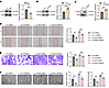 ERK phosphorylation is essential for CAVIN3-mediated regulation of patholog