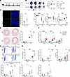 Loss of IAMP exacerbates ischemia/reperfusion injury in the heart.