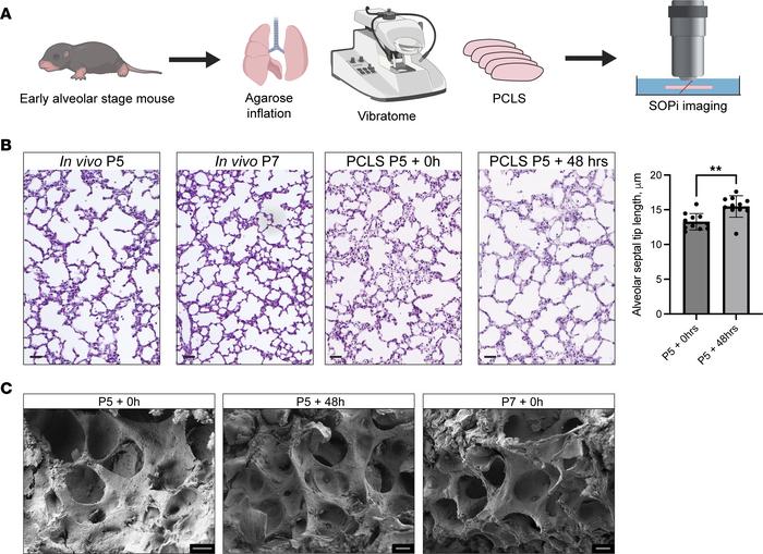Precision-cut lung slices (PCLS) model of alveologenesis ex vivo.
(A) Fi...
