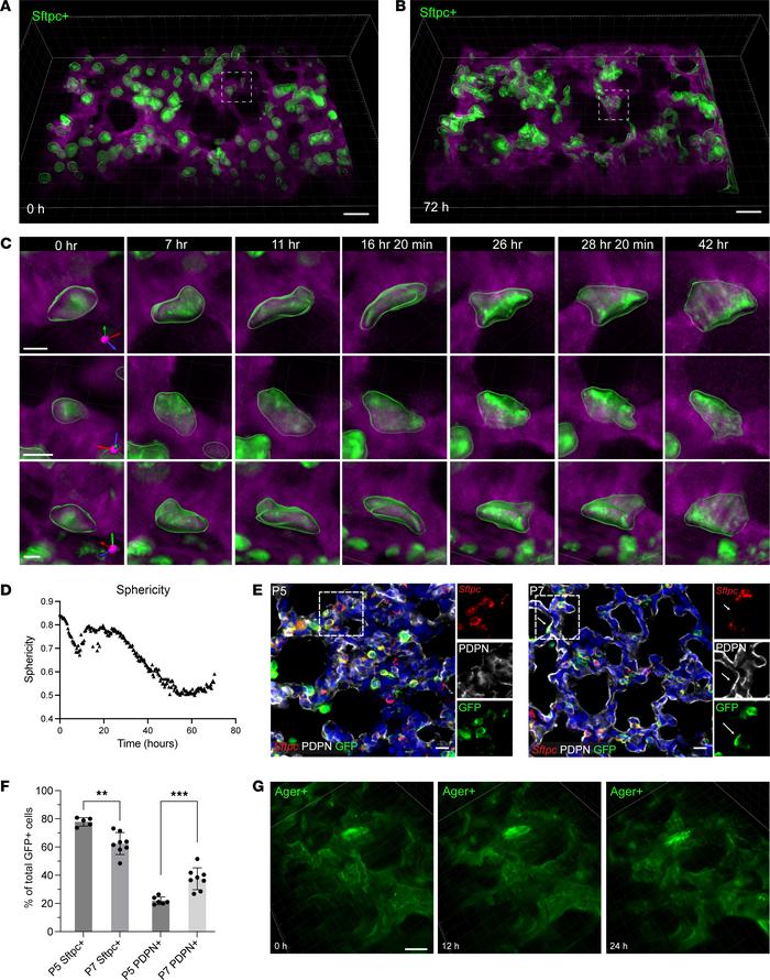 Alveolar type 2 cells undergo changes in cell shape that are associated ...