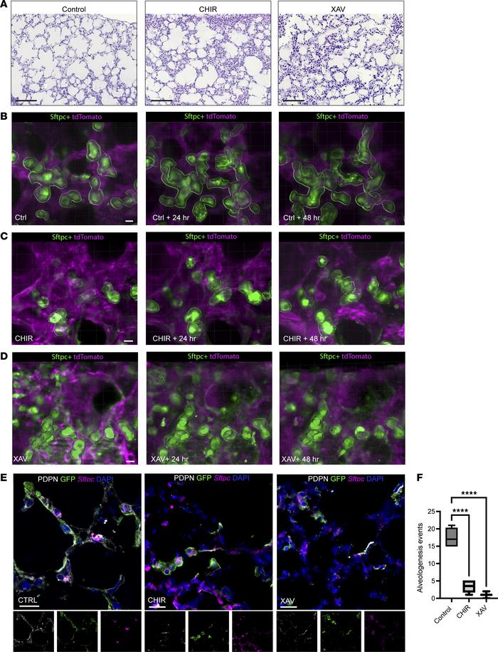 Modulation of the Wnt pathway disrupts alveologenesis, with decreased ep...