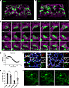Alveolar type 2 cells undergo changes in cell shape that are associated wit