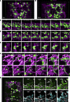 Alveologenesis is characterized by epithelial ballooning outgrowth.