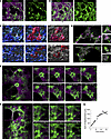 Mesenchymal ring structure dynamics and contraction are required for alveol