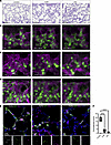 Modulation of the Wnt pathway disrupts alveologenesis, with decreased epith