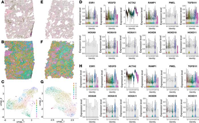 Unbiased clustering of LAM tissue and marker expression.
(A and E) H&amp...