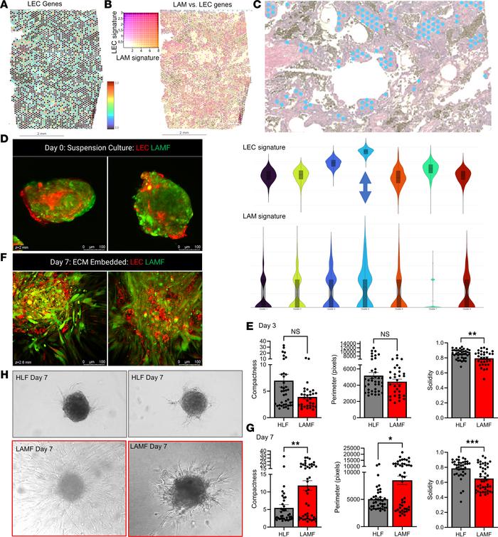 LAMF-LEC organoids have increased invasion into the ECM.
(A) Spatial hea...