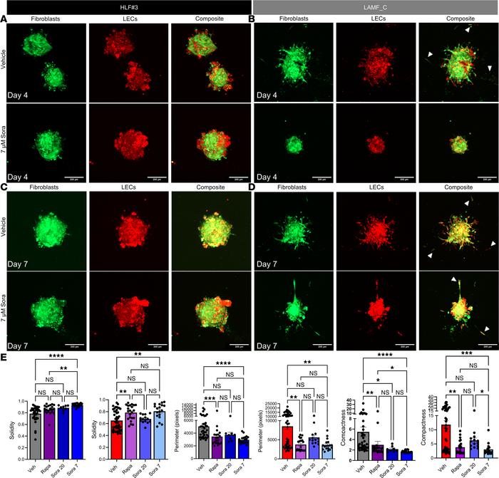 Sora treatment inhibits migration and invasion of LAMF-LEC spheroids.
(A...