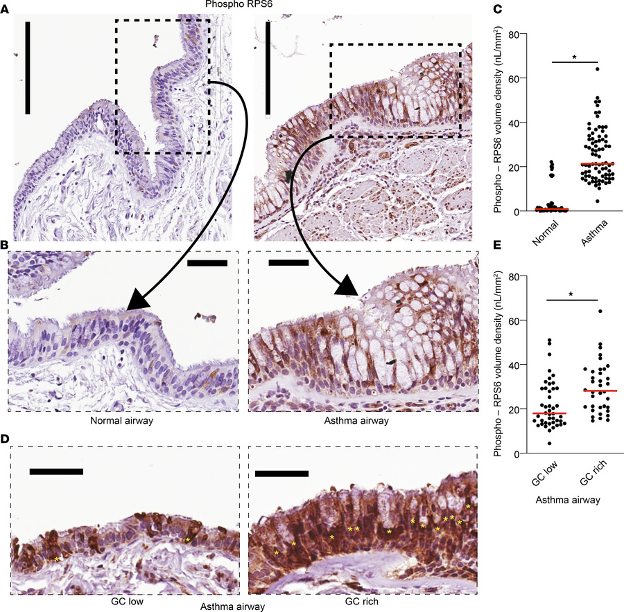 Increased MTOR signaling in asthmatic airway epithelium.
(A) Representat...