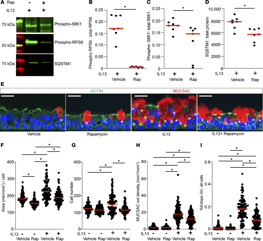 MTOR regulates airway epithelial hypertrophy, hyperplasia, and ectopic g...