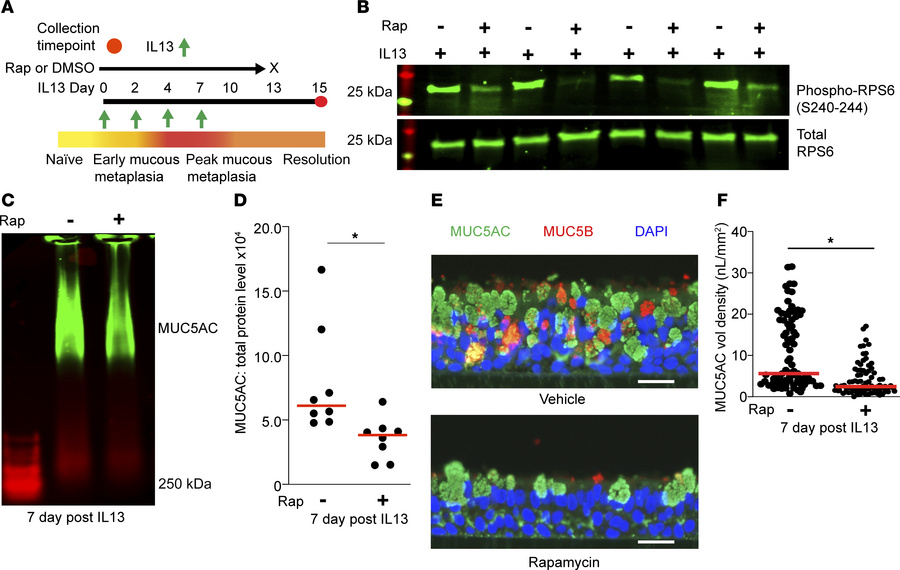 MTOR inhibition hastens resolution of IL-13–mediated mucous metaplasia b...
