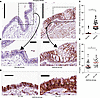 Increased MTOR signaling in asthmatic airway epithelium.