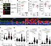MTOR regulates airway epithelial hypertrophy, hyperplasia, and ectopic gobl