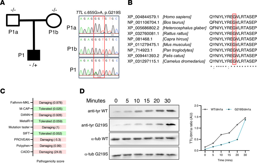 Identification of TTL variant and enzyme activity assay.
(A) Pedigree of...