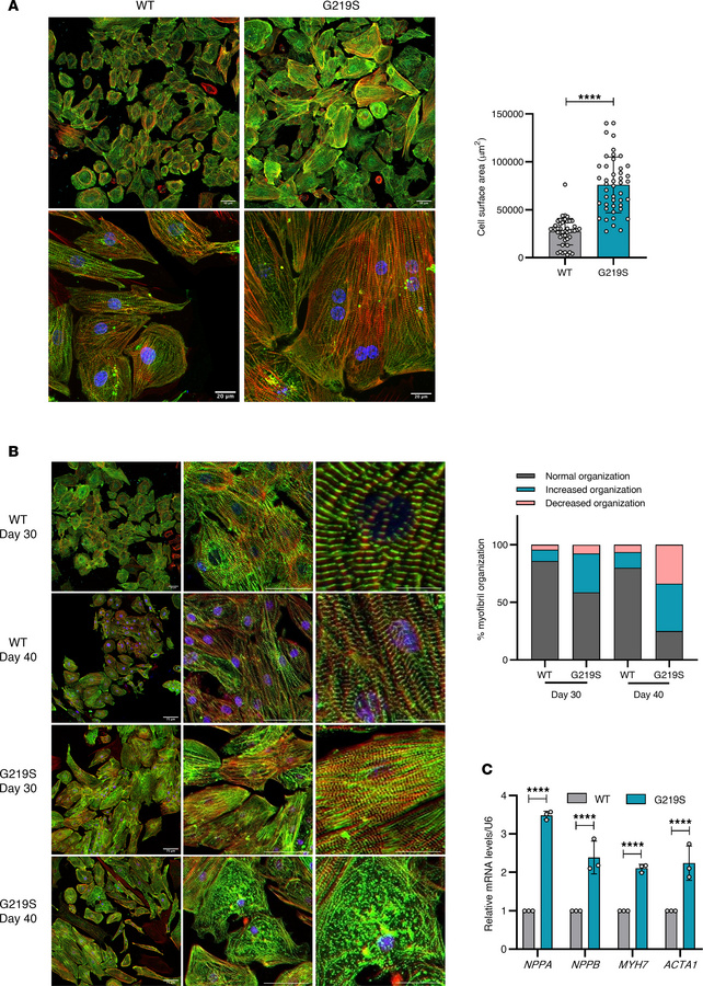 TTL p.G219S iPSC-CMs exhibit hypertrophic phenotypes.
(A) Representative...