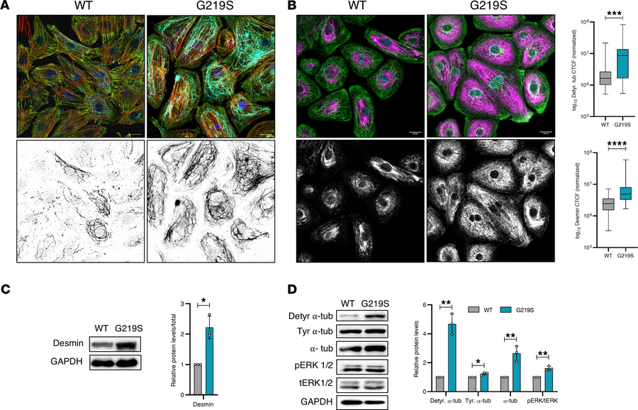 TTL p.G219S iPSCs-CMs showing increased levels of detyrosinated α-tubuli...