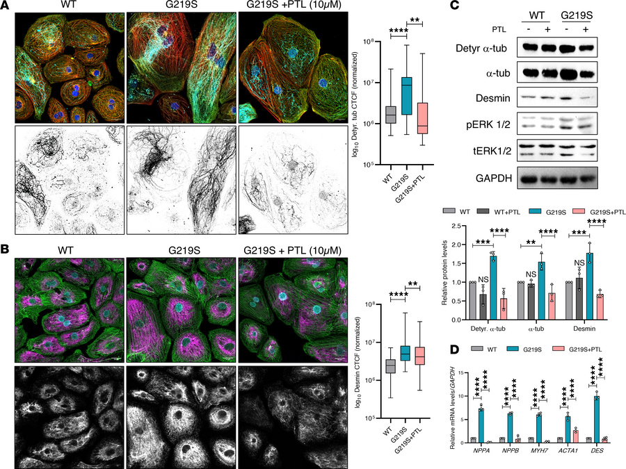 PTL treatment in TTL p.G129S iPSC-CMs normalizes α-tubulin detyrosinatio...