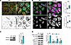 TTL p.G219S iPSCs-CMs showing increased levels of detyrosinated α-tubulin a