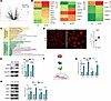 Transcriptome analysis TTL p.G219S iPSCs-CMs showing increased ROS levels a