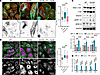 PTL treatment in TTL p.G129S iPSC-CMs normalizes α-tubulin detyrosination.