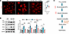 PTL treatment rescued redox stress in TTL p.G219S iPSC-CMs.