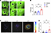 The presence of ivacaftor in combination with elexacaftor and tezacaftor is