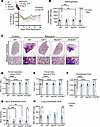 Deletion of CB1R in myeloid cells, but not in AT2 cells, prevents PF.