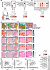 Spatial transcriptomics analysis of the human IPF lungs reveals the importa