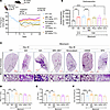 Dual inhibition of CB1R and iNOS by MRI-1867 provides superior antifibrotic