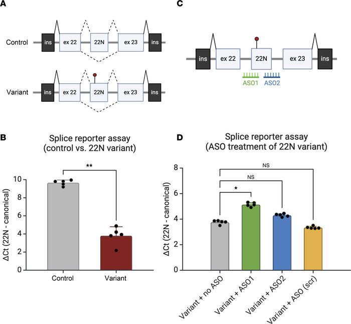 An in vitro minigene assay demonstrates aberrantly increased inclusion o...