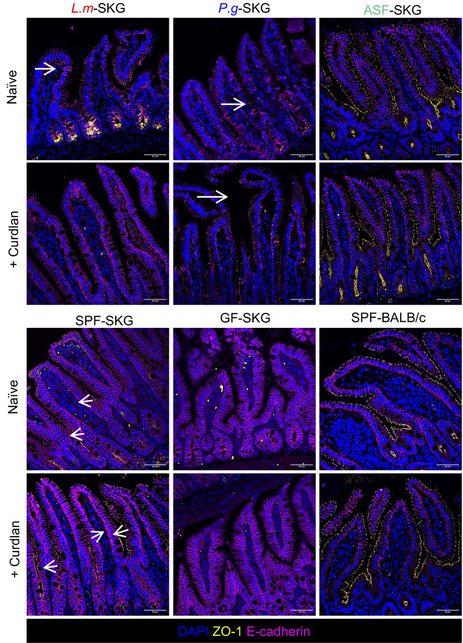 Gut tight junction protein ZO-1 is altered in germ-free and monoassociat...