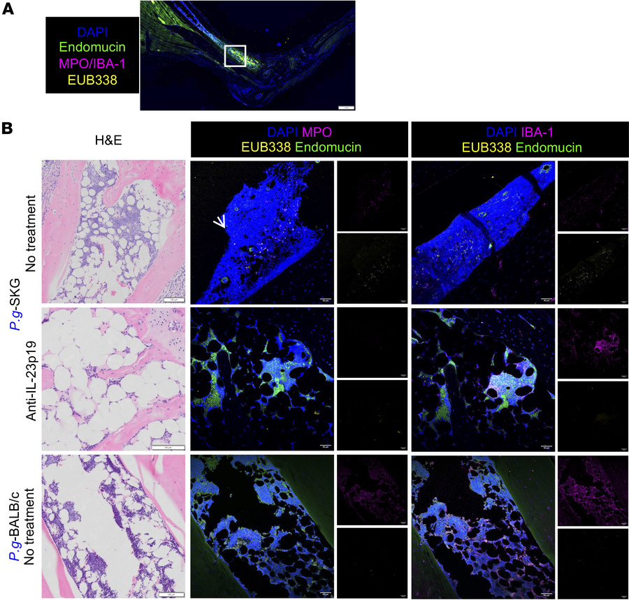 
P. goldsteinii translocation to the bone marrow of inflamed ankles is r...
