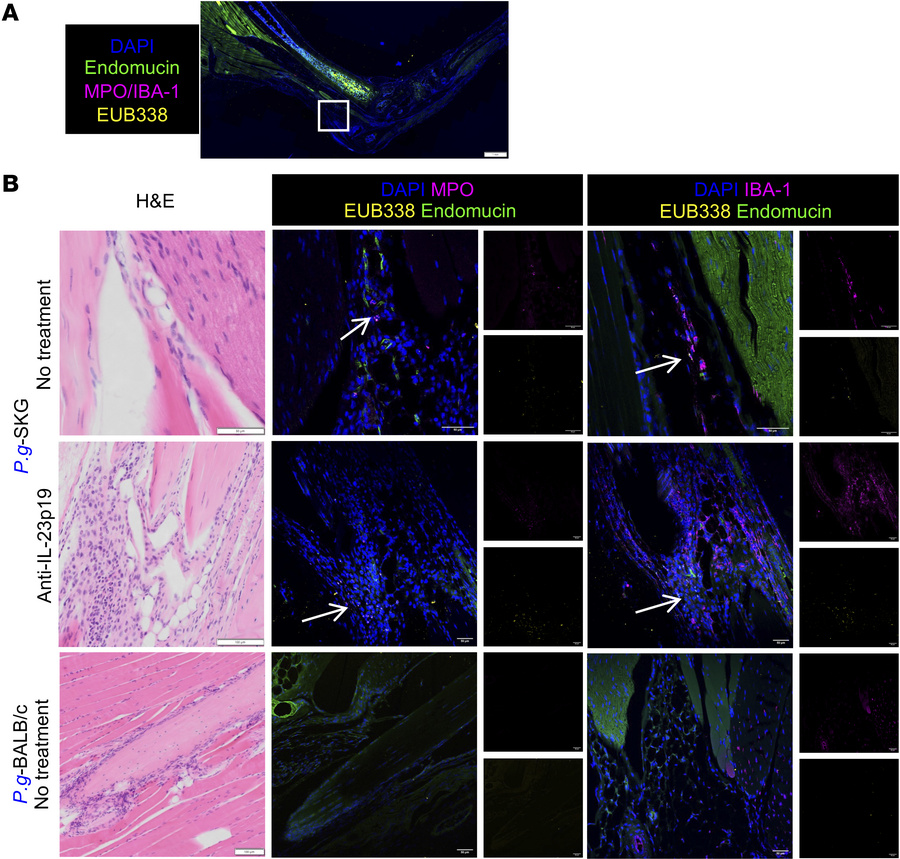 
P. goldsteinii translocation to the enthesis of inflamed ankles is not ...