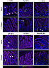Gut tight junction protein ZO-1 is altered in germ-free and monoassociated