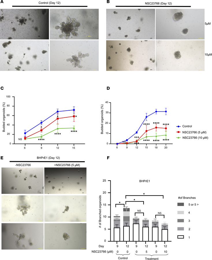 NSC23766 induced an impairment of prostatic organoid branching that phen...