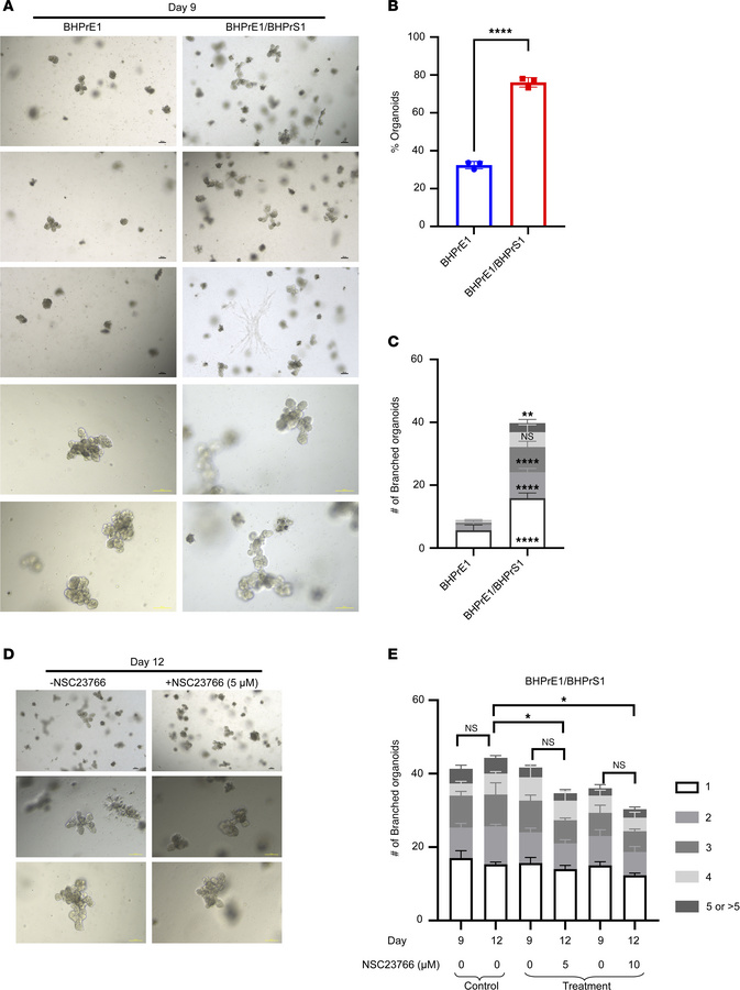 NSC23766 exposure resulted in impaired organoid branching in cocultures ...