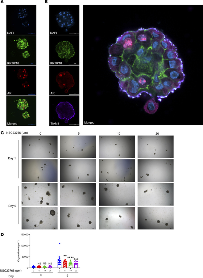 NSC23766 exposure resulted in growth inhibition of BPH patient-derived o...