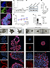 TIAM1 is critical to the prostatic branching phenotype.