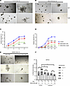 NSC23766 induced an impairment of prostatic organoid branching that phenoco