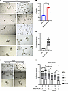 NSC23766 exposure resulted in impaired organoid branching in cocultures wit